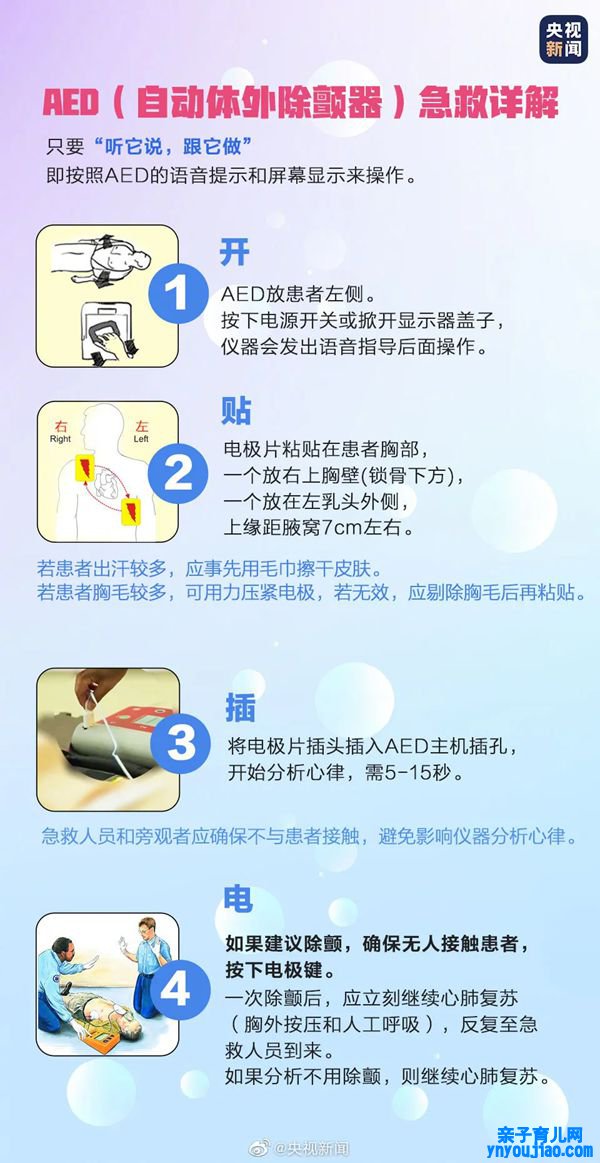 AED是什么意思,AED除颤仪利用步调