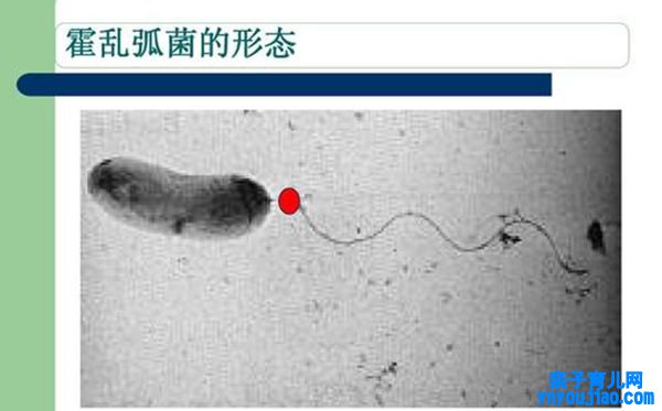 霍乱孤菌的形态